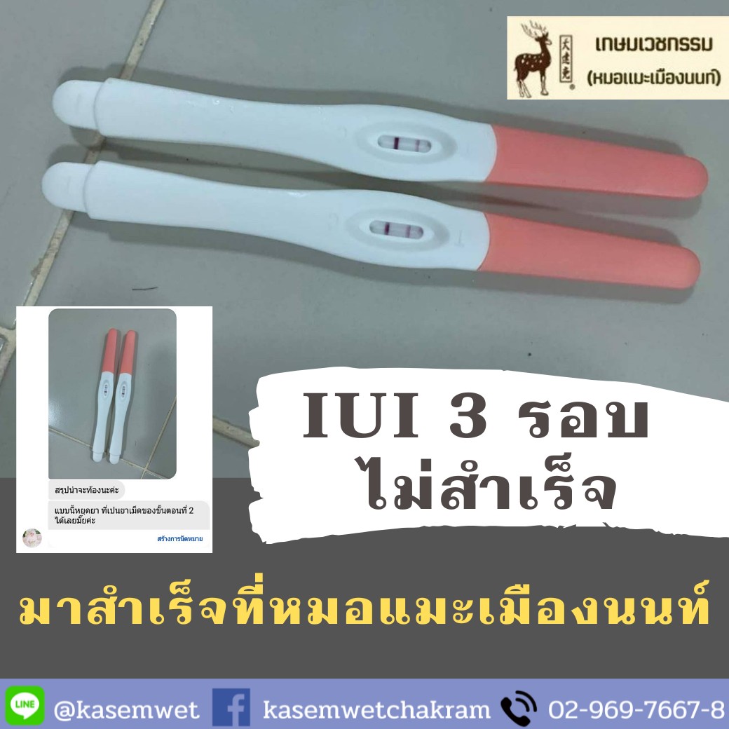 ผลสำเร็จภาวะมีบุตรยาก